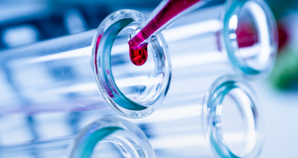 GettyImages 1059361040 scaled e1581004049791 scaled