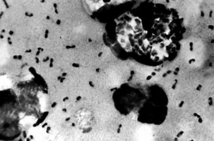 Decretan alerta en China por brote de Peste Negra