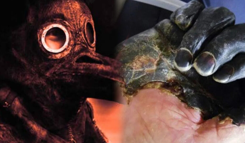 La peste negra reaparece en California, Estados Unidos