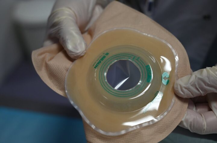bolsa-colostomia